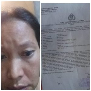 Diduga Laporan Korban Penganiayaan di Polsek Percut Sei Tuan Jalan Ditempat