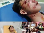 Terduga Pelaku Geng Motor Yang Bantai Pelajar di Cemara Medan Masih Berkeliaran, 2 Sudah Ditangkap
