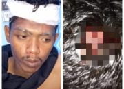 Miris!!! Wartawan dan Juga Anggota IWO Indonesia Banyuasin di Aniaya