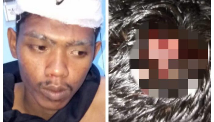 Miris!!! Wartawan dan Juga Anggota IWO Indonesia Banyuasin di Aniaya