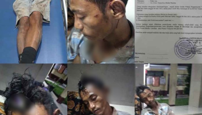 Masih Satu Tersangka Ditangkap, Polsekta Medan Labuhan Belum Menangkap Tersangka Lain Penganiayaan Irrudi pada Mei 2023 Lalu