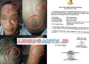 Oknum TNI Aniaya Pemuda Hingga Babak Belur di Medan