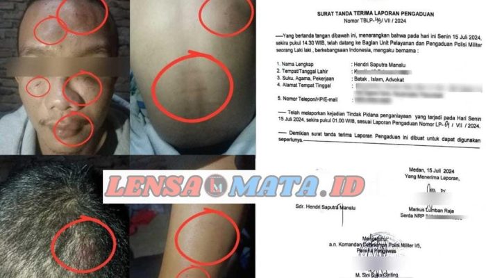 Oknum TNI Aniaya Pemuda Hingga Babak Belur di Medan