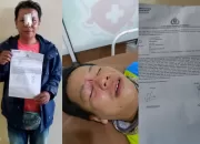 Mengaku Anak Pejabat, Pelaku Aniaya Korban Membabi Buta