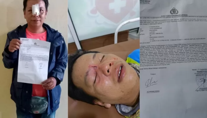 Mengaku Anak Pejabat, Pelaku Aniaya Korban Membabi Buta