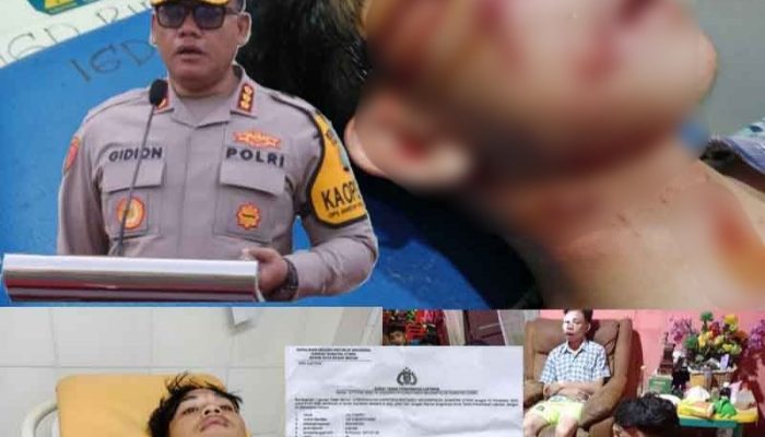 Hampir Setahun 8 Pembegal 4 Pelajar Tak Tertangkap, Ini Kata Kapolrestabes Medan