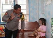 Kapolres Nias Selatan Kunjungi Bocah Viral Diduga Korban Kekerasan dan Beri Perhatian Khusus