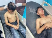 Atlet Tarung Derajat Peraih Medali Emas Jadi Korban Geng Motor di Kisaran, Pengprov Kodrat Sumut Minta Polisi Bertindak Tegas